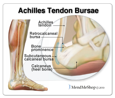 The retrocalcaneal bursa and subcutaneous calcaneal bursa protect the Achilles tendon from damage due to friction.